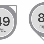 Two examples of Dexcom trend arrows