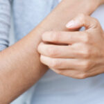 Diabetes and Itching - Causes and Treatment Options