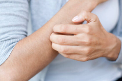 Diabetes and Itching - Causes and Treatment Options